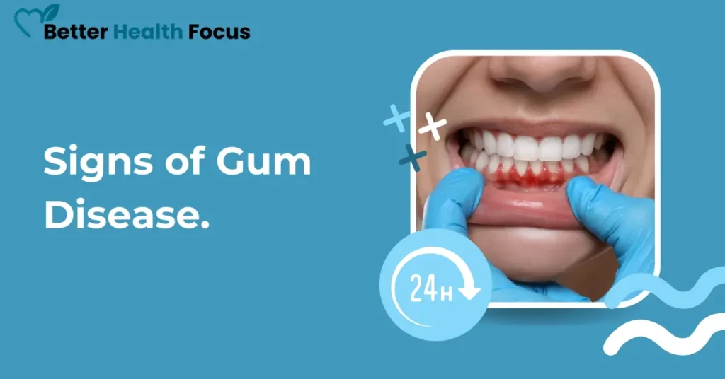 Early Signs of Gum Disease and How to Treat It at Home Signs of Gum Disease